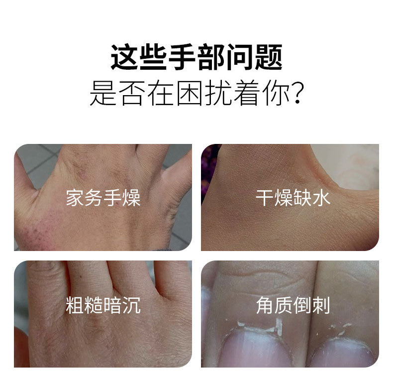 護(hù)手霜幫您解決手部以下問(wèn)題 護(hù)手霜幫您解決手部以下問(wèn)題
