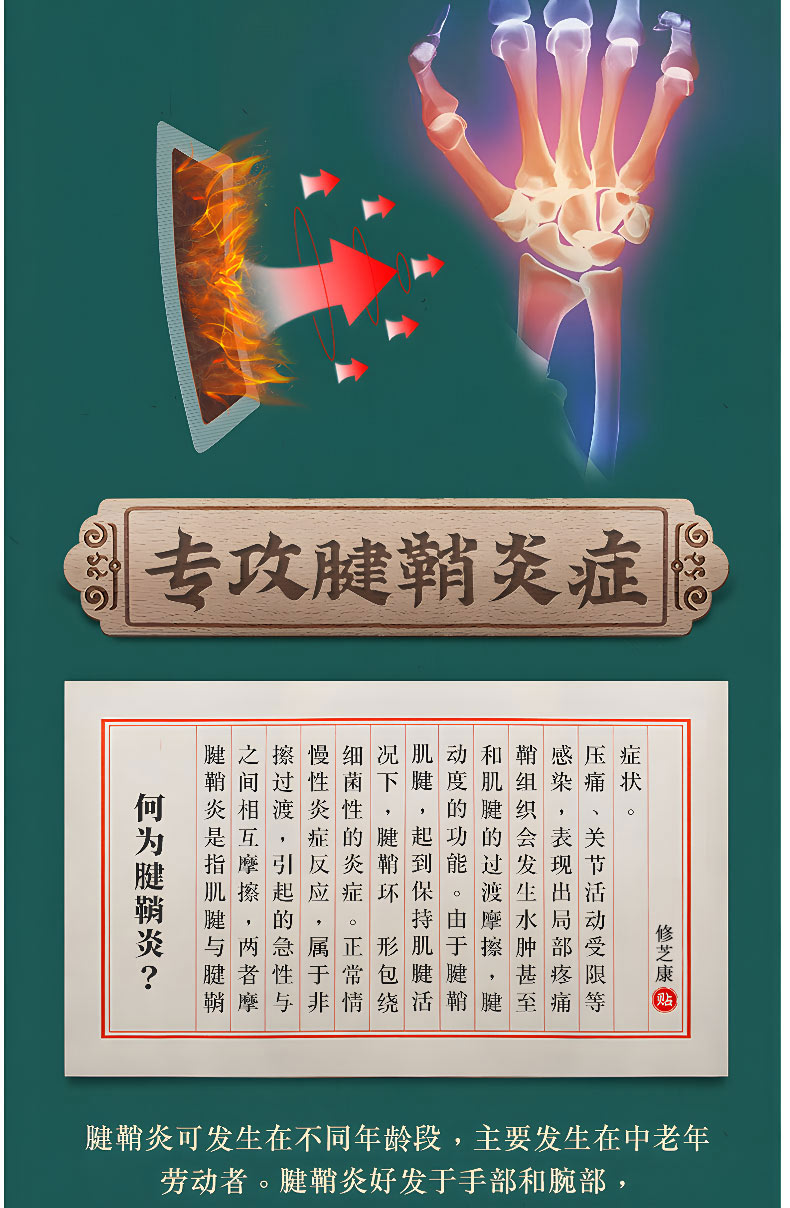 何為腱鞘炎 何為腱鞘炎