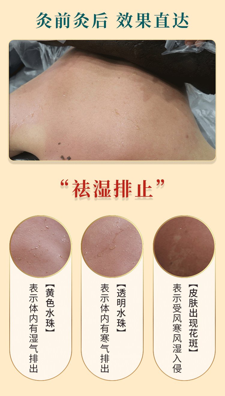 草本熱灸膏使用效果對(duì)比 草本熱灸膏使用效果對(duì)比