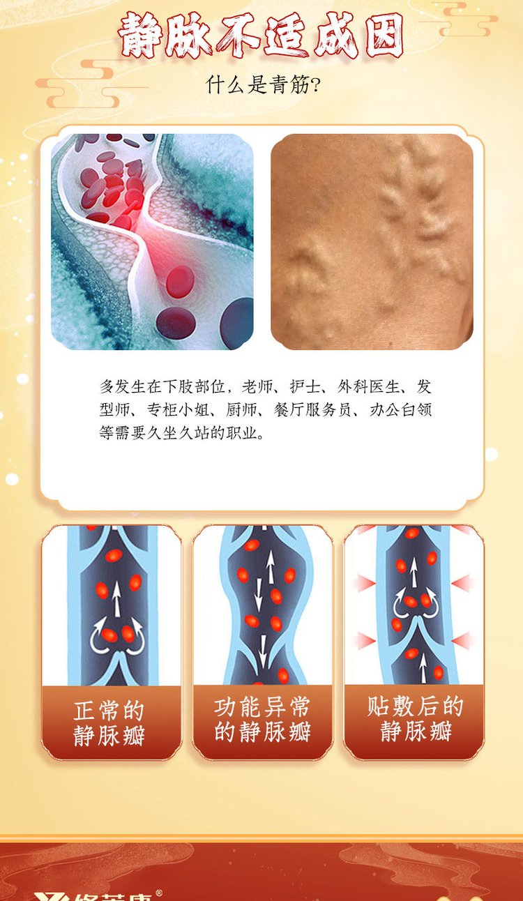 什么是青筋 什么是青筋
