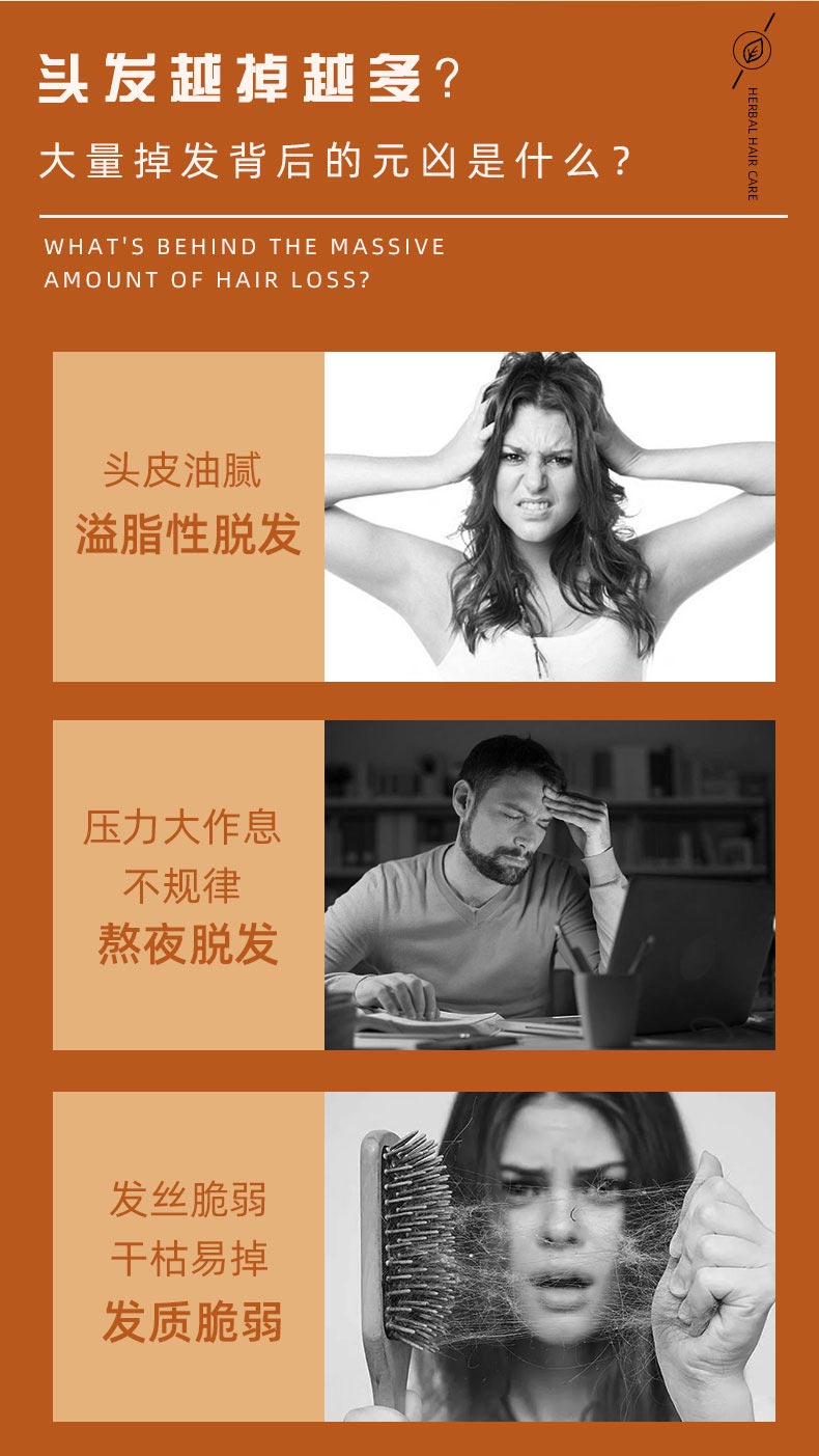 育發(fā)液適用人群 育發(fā)液適用人群